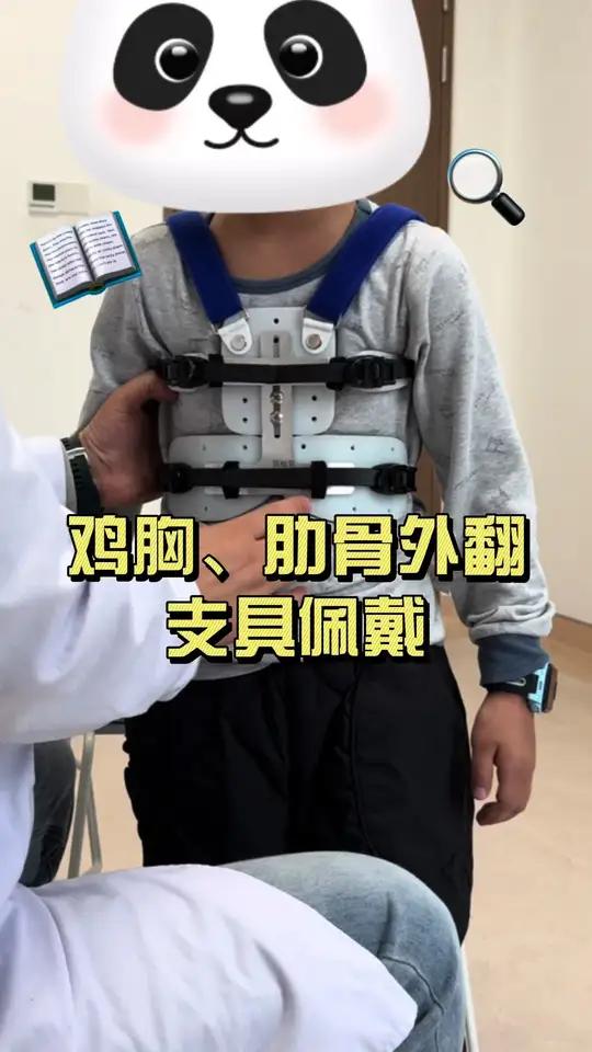 鸡胸、肋骨外翻支具佩戴