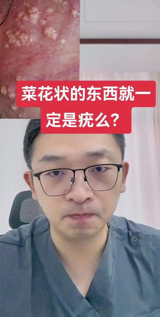 菜花状的改变就一定是病毒疣吗
