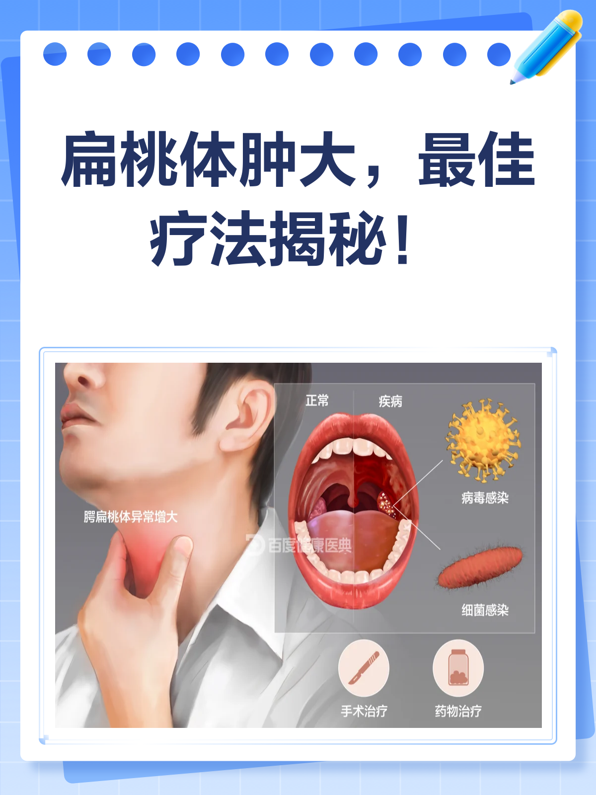 扁桃体肿大,治疗选哪种?一文读懂!