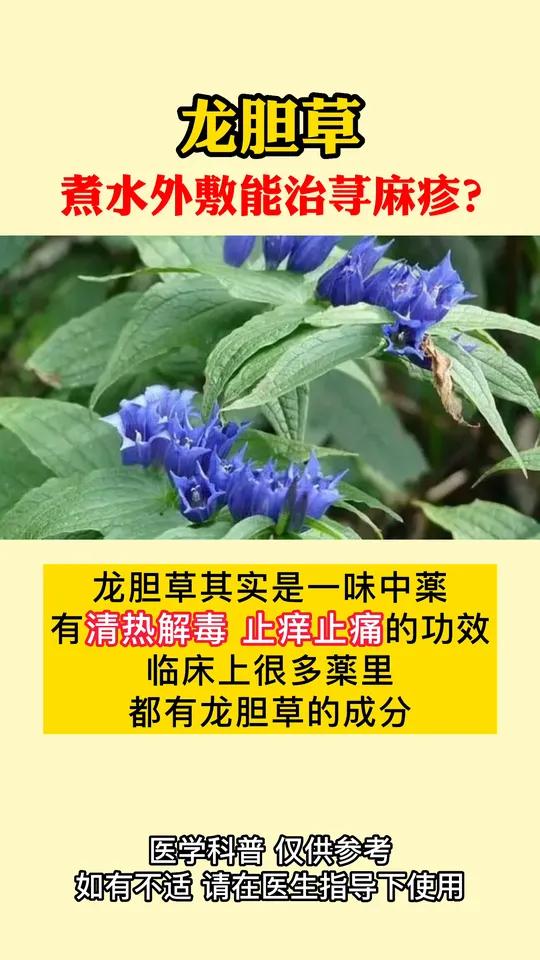 荨麻疹