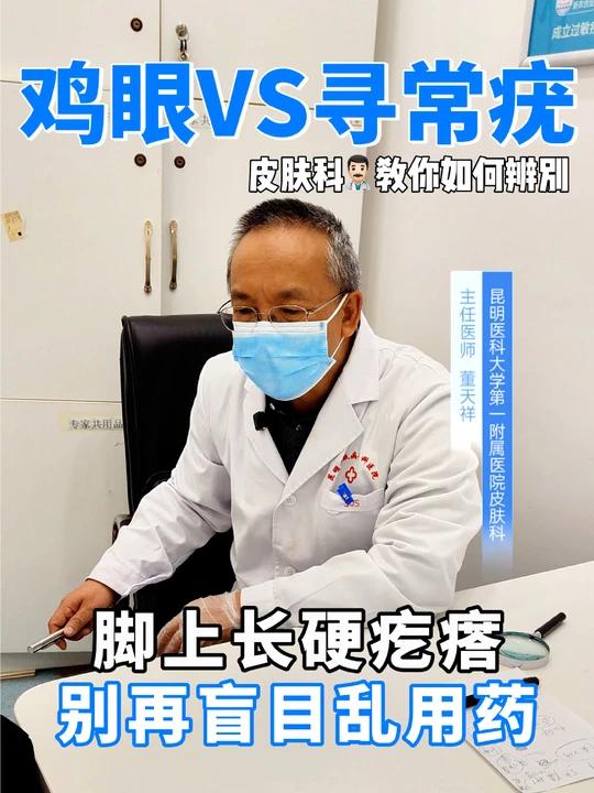 脚上长硬疙瘩，是鸡眼还是寻常疣？