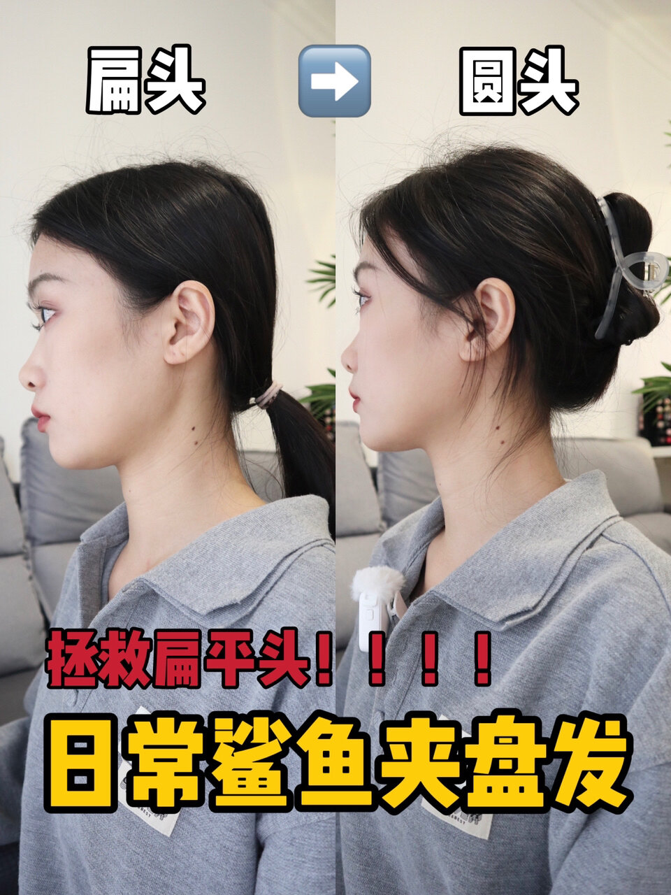 谢谢这2个鲨鱼夹发型,拯救扁头还显发量!