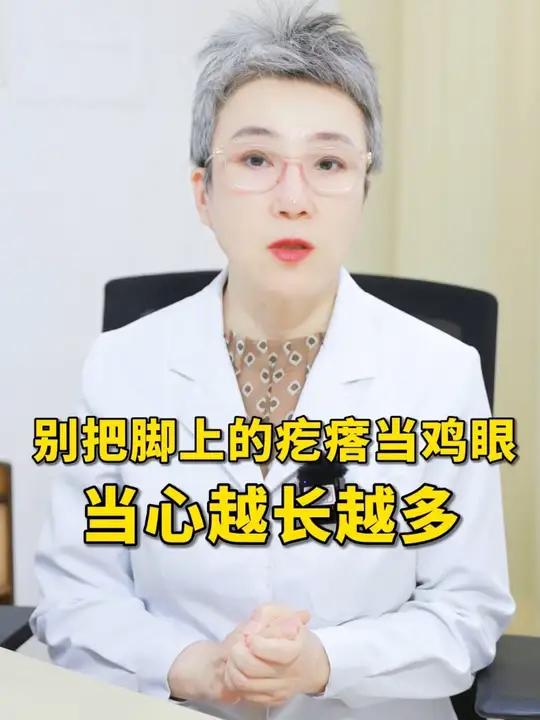 脚底板长出硬疙瘩,别当成鸡眼瞎搞,当心越长越多!