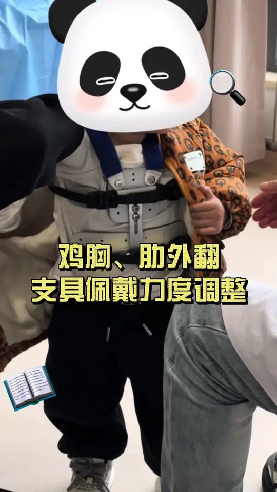 鸡胸、肋骨外翻的支具佩戴力度调整 鸡胸肋骨外翻抖出健康知识宝藏医学科普 胸壁畸形