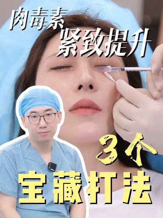 老白科普:肉毒素的3个宝藏打法 肉毒素 医学科普注射美容鱼尾纹 除皱针