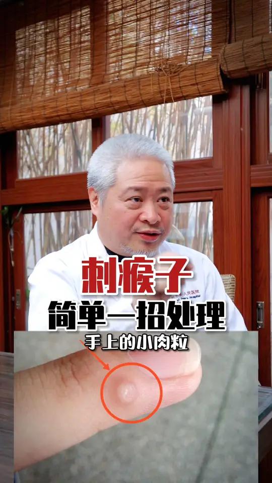 手上长小肉粒,寻常疣这样处理