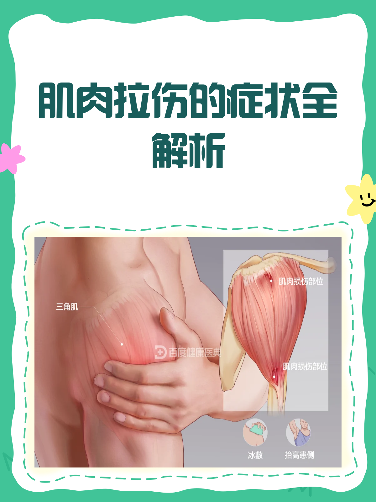 肌肉拉伤来袭?这些症状你得知道!