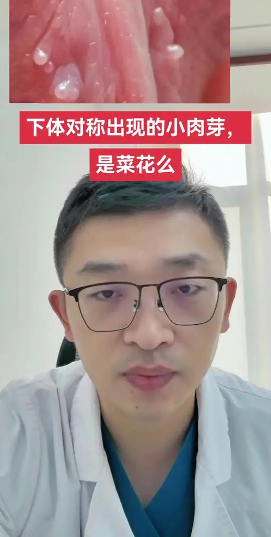 下体部位对称出现的小肉芽