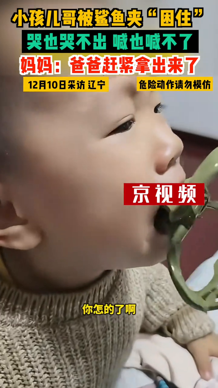 小孩儿哥被鲨鱼夹“困住”,哭也哭不出,喊也喊不了