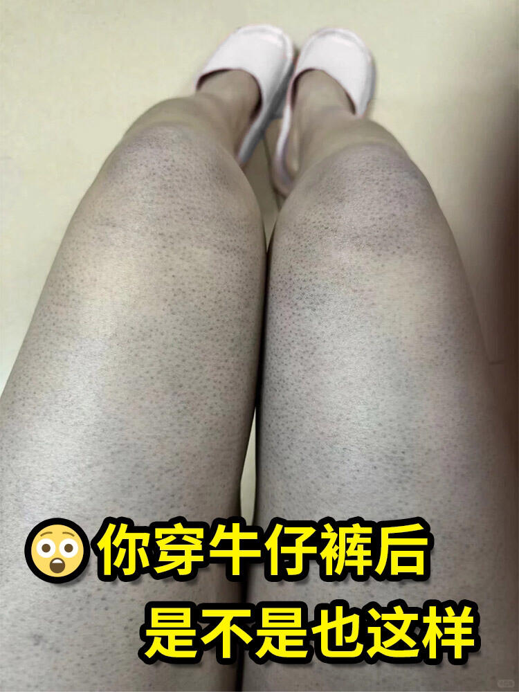 你穿完牛仔裤,是不是也会这样?