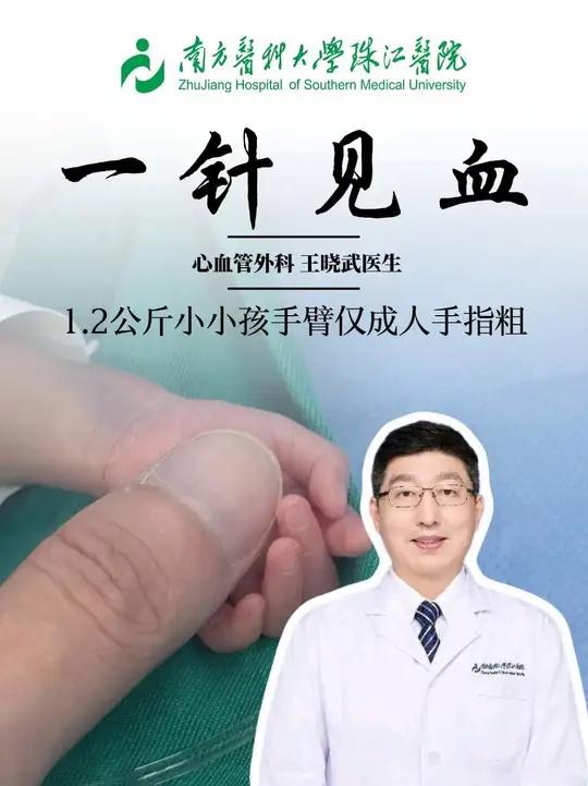 体重1.22公斤的早产宝宝动脉导管未闭,超声都看不到的动脉,被我们医护小姐姐耐心找到了!#