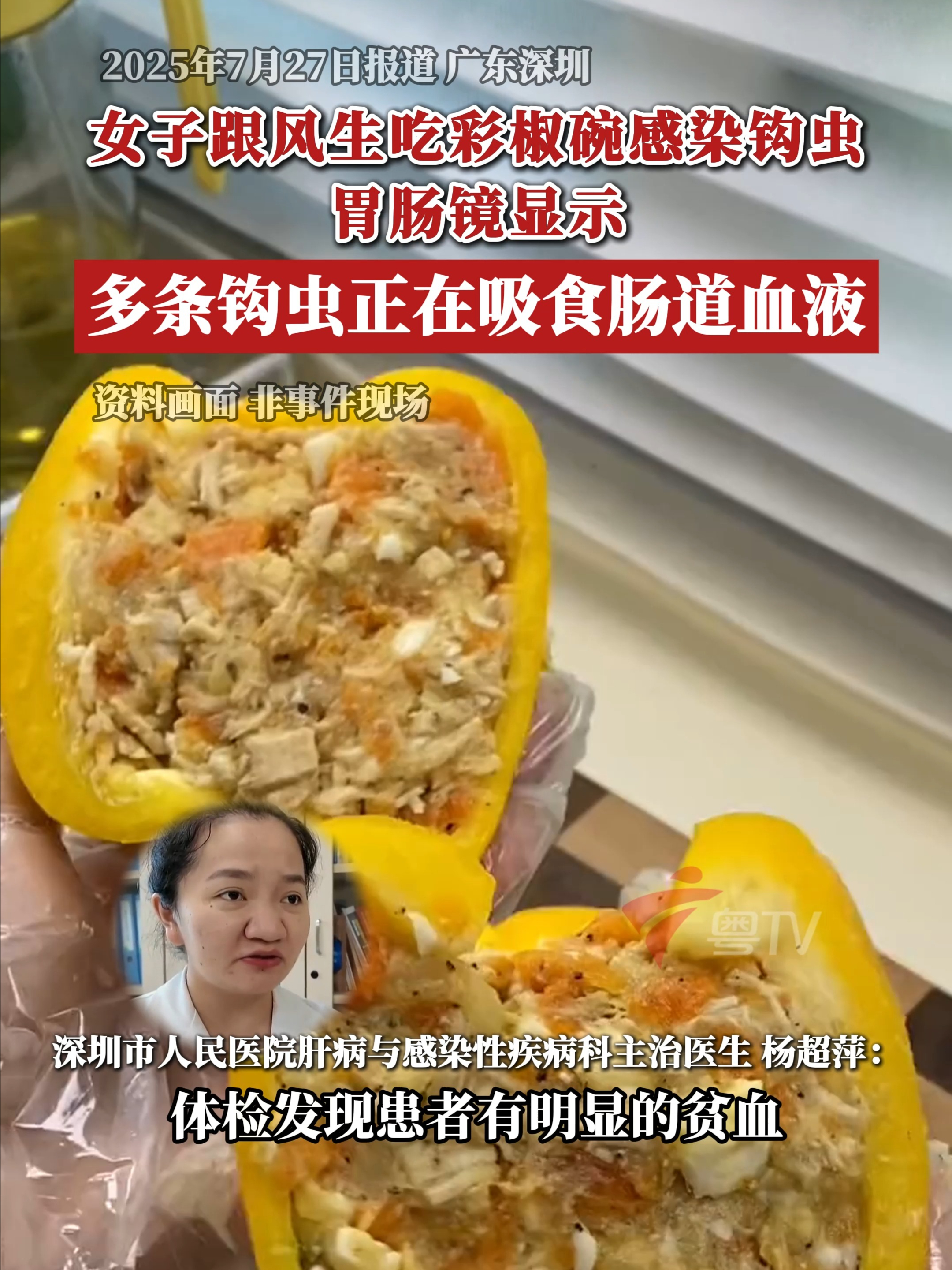 女子跟风生吃彩椒碗感染钩虫,胃肠镜显示钩虫正在吸食肠道血液