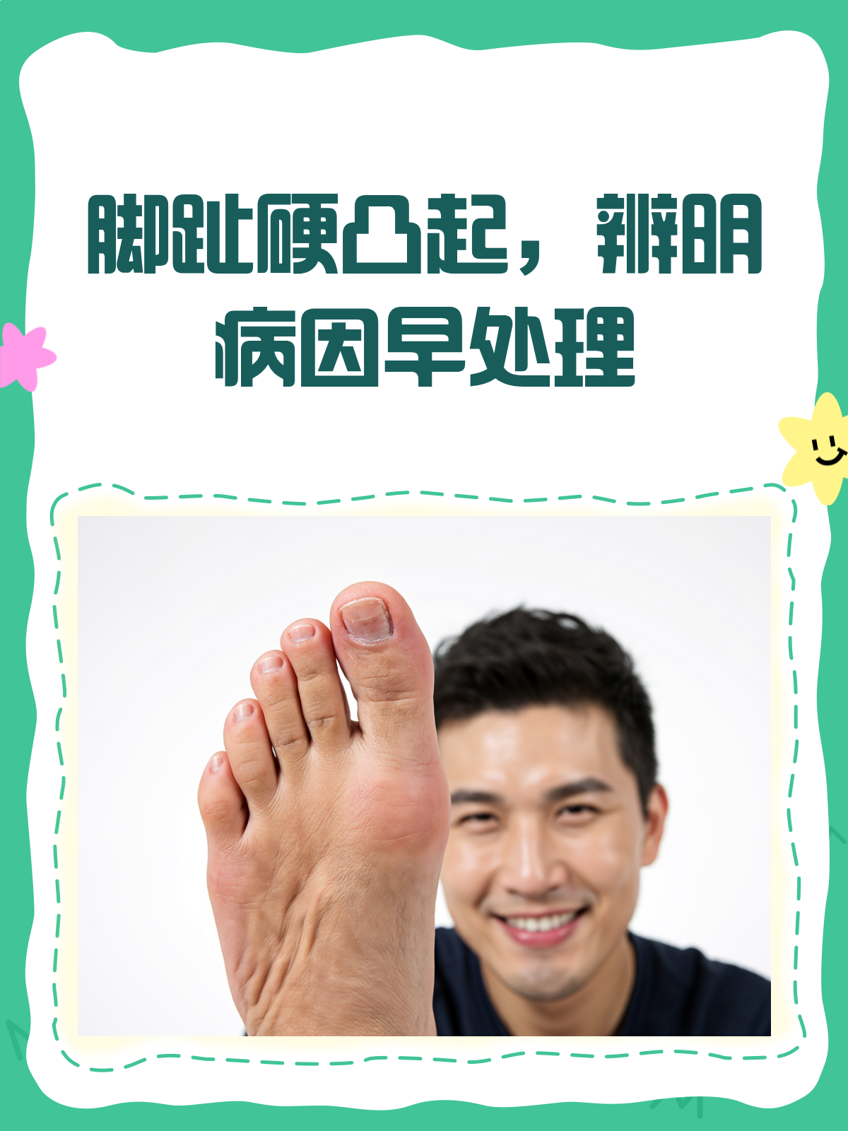脚趾上的硬凸起?揭秘跖疣、鸡眼还是啥?
