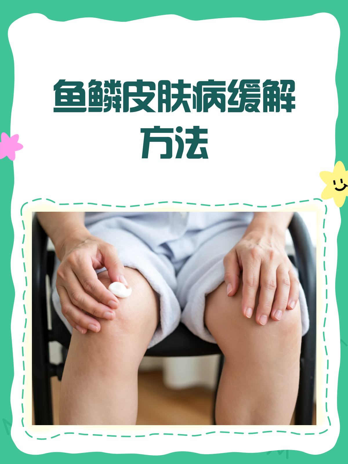 鱼鳞皮肤病难根治?别急,这些方法能帮你缓解!