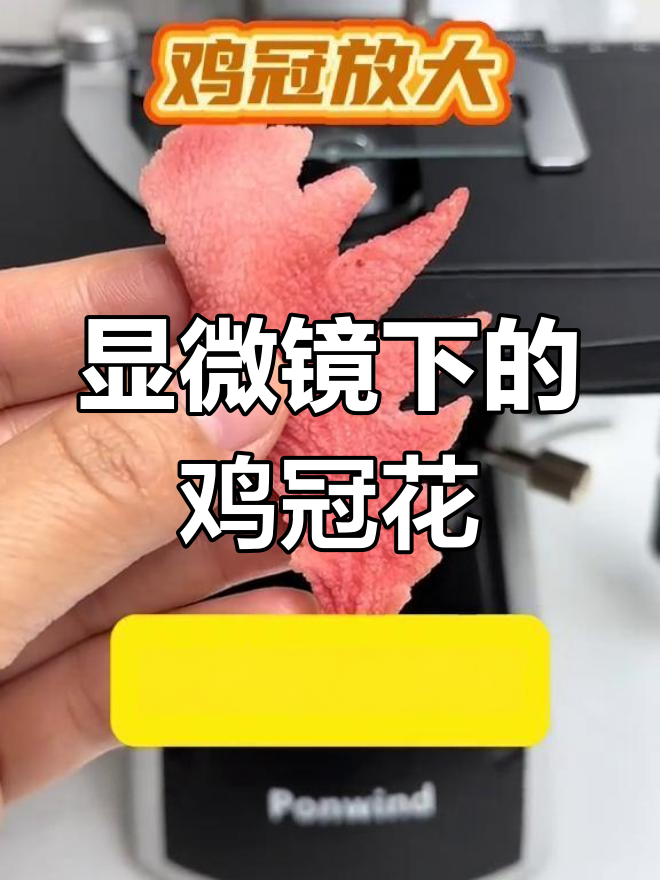 鸡冠花的微观世界,你敢看吗?