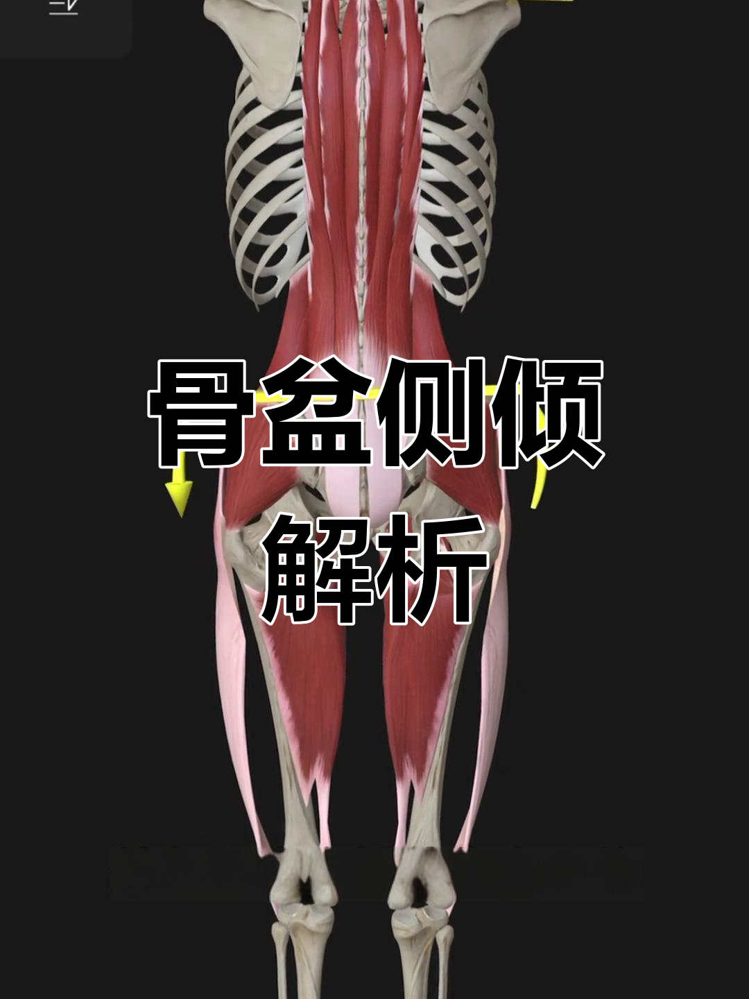 骨盆倾斜的成因与稳定肌肉系统,了解它才能有效矫正