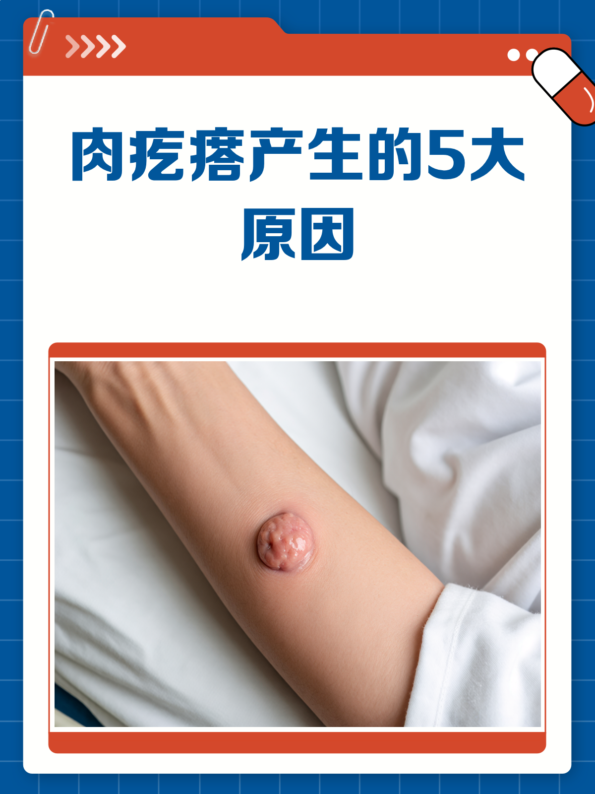 皮肤长肉疙瘩?快来看看是哪些原因在作怪!