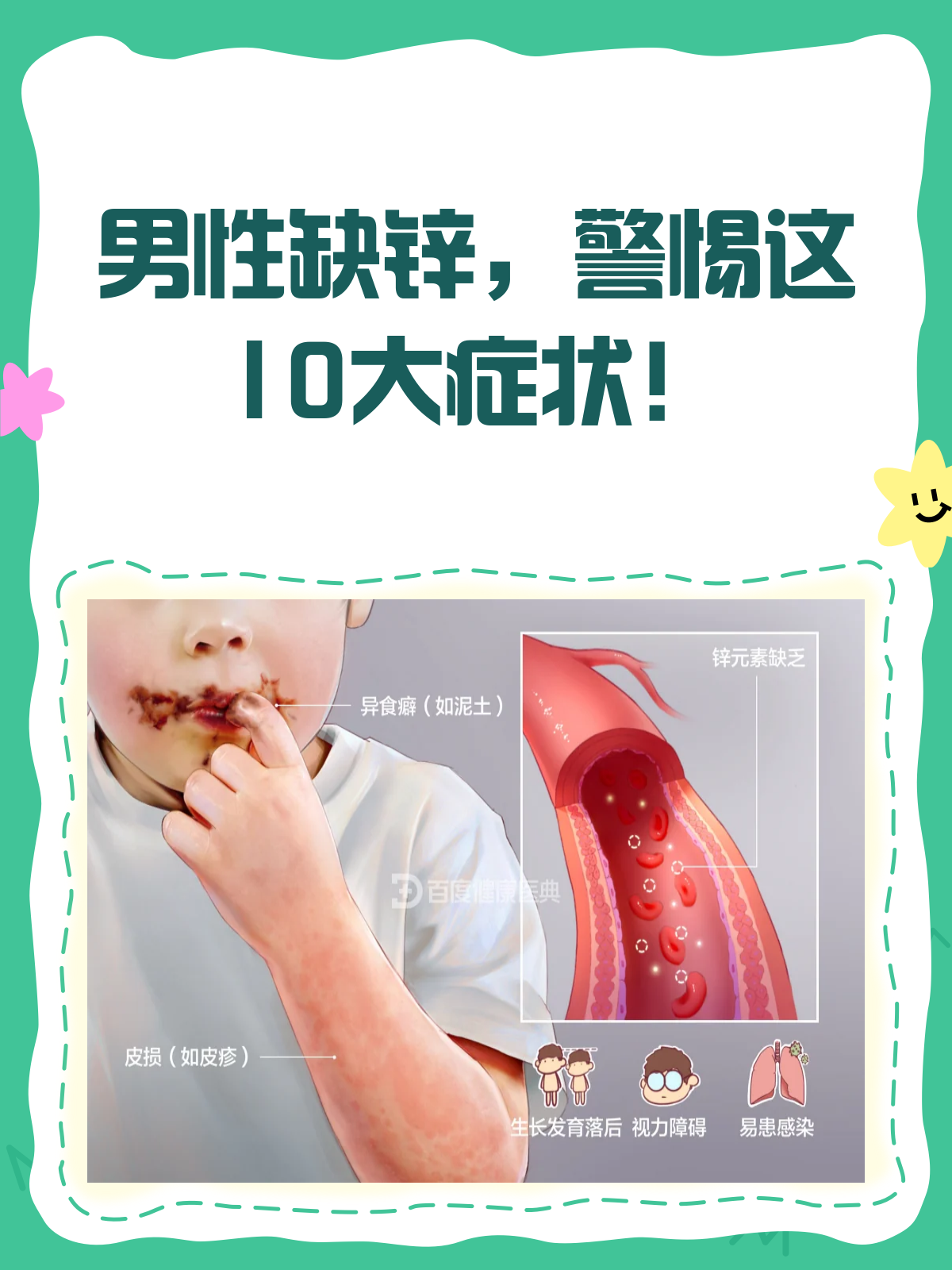 男性缺锌的10大症状，你中招了吗？