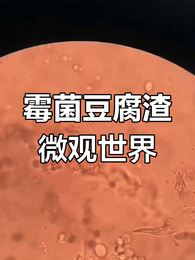 显微镜下的霉菌与豆腐渣