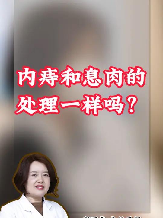 内痔和息肉的处理一样吗?