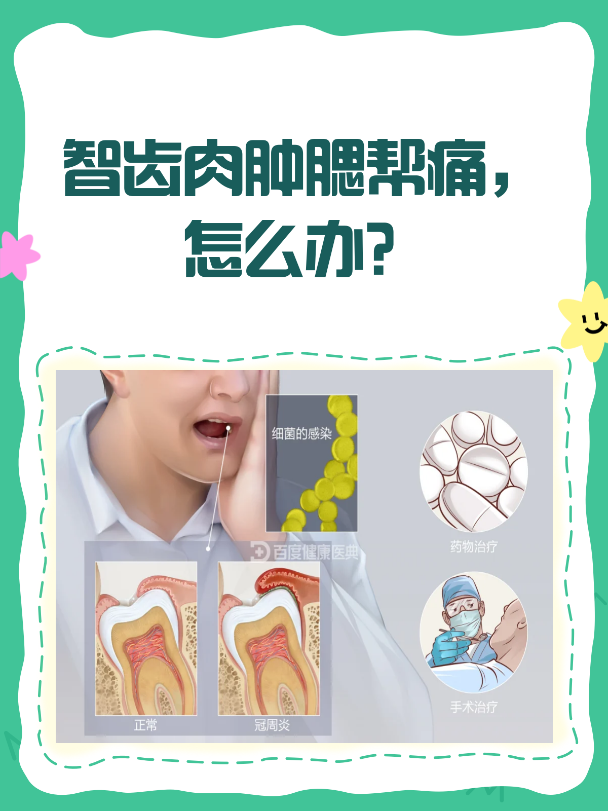 智齿旁肉肿腮帮痛？快来看看怎么回事！