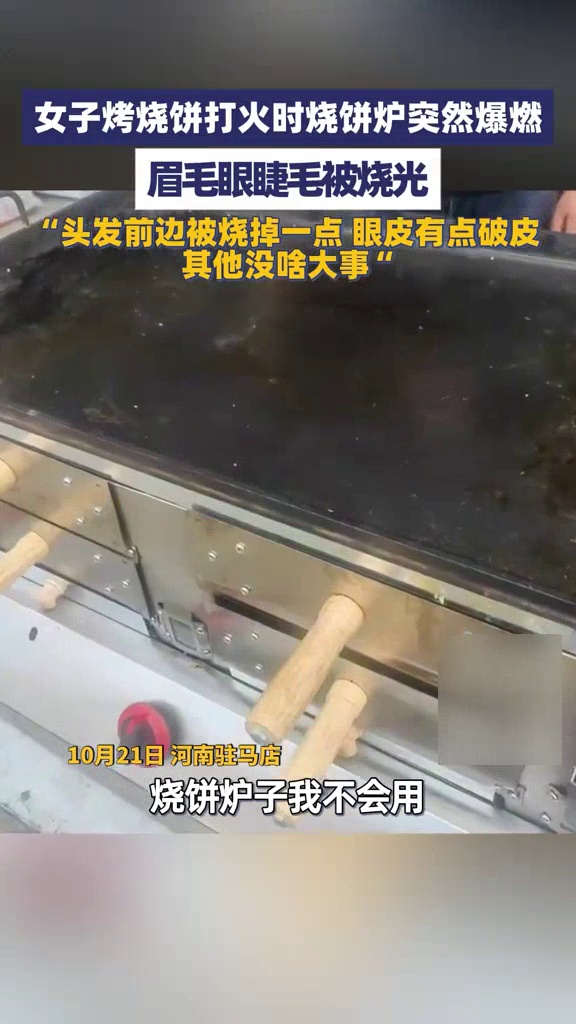 女子烤烧饼打火时烧饼炉突然爆燃,眉毛睫毛瞬间被烧光