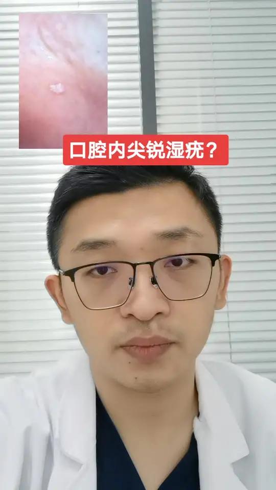 口腔尖锐湿疣