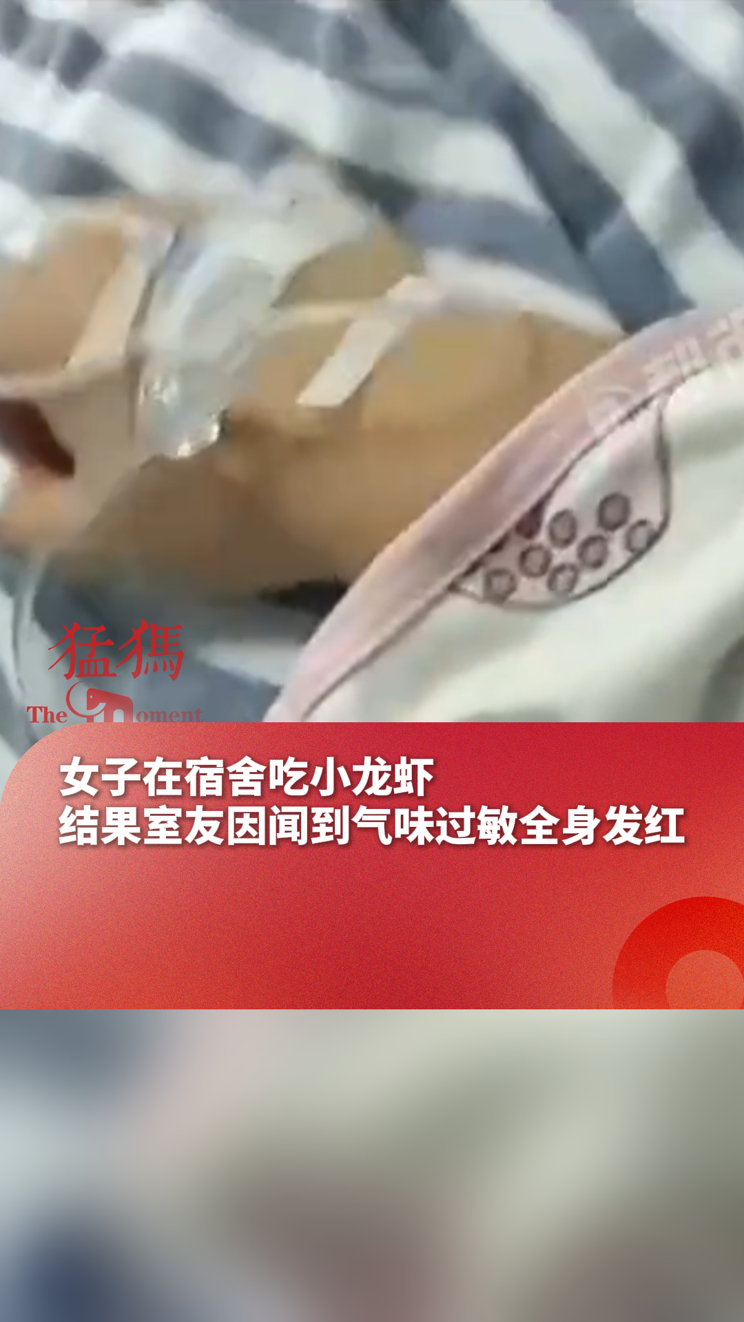 女子在宿舍吃小龙虾,结果室友因闻到气味过敏 全身发红