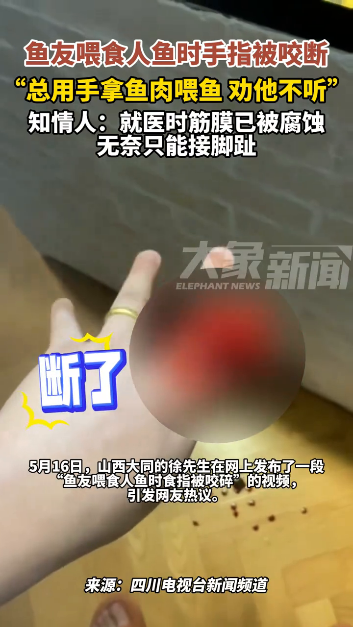 鱼友总喜欢用手拿肉喂食人鱼,手指被咬断