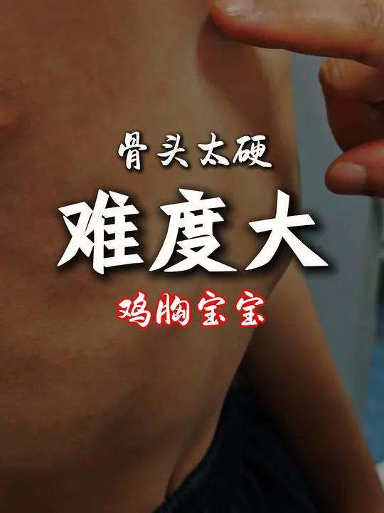 鸡胸矫正的难度,是不一样的。胸肋骨僵硬,矫正的难度就会增加