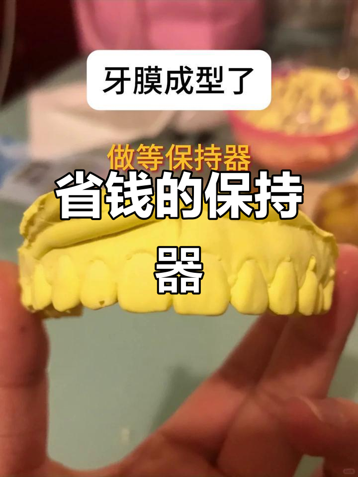 网上定制保持器,省钱又舒适,效果堪比线下!