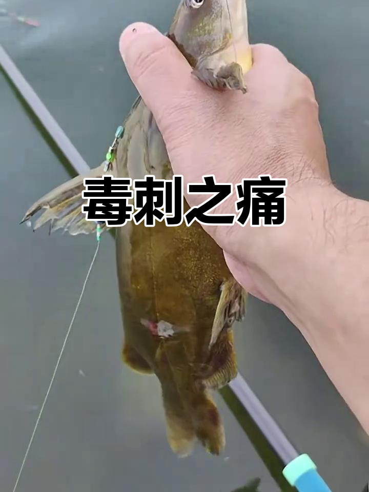 黄颡鱼背刺有毒,被扎后疼痛难忍