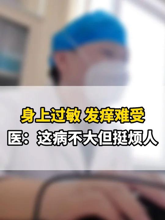 身上过敏 发痒难受 医生:这病不大 挺烦人