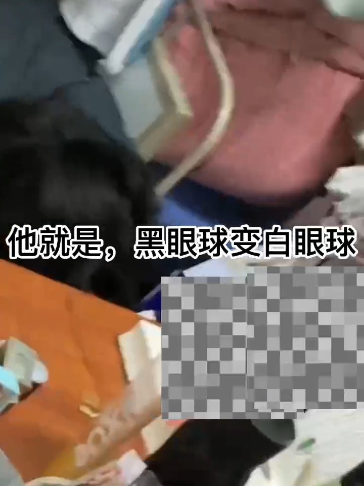 《因核辐射眼珠变异的小孩》