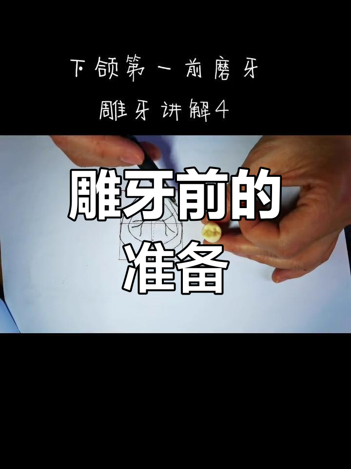 雕刻前,先了解牙体形态并准确转移到蜡块