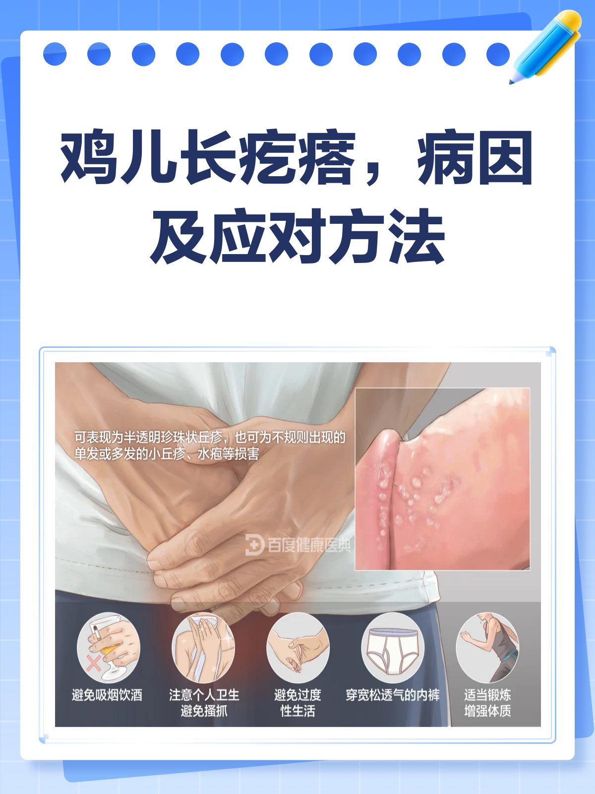 鸡儿上长了疙瘩？别急，先看这篇！