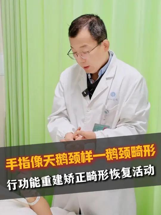 手指像天鹅颈样—鹅颈畸形,行功能重建矫正畸形恢复活动手外科#手指畸形 #鹅颈畸形