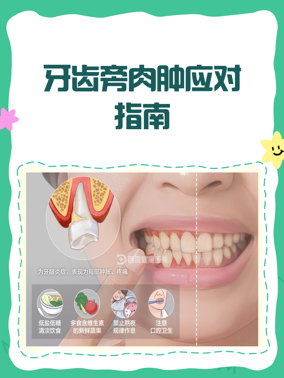 牙齿旁肉肿了？别急，这样处理就对了！