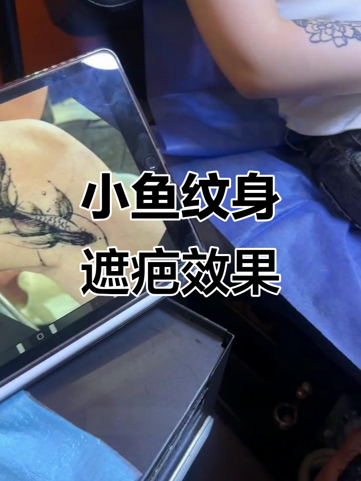 膝盖疤痕巧妙遮盖，小鱼纹身完美修饰