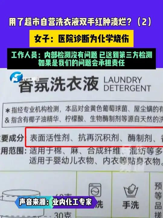 10月24日(发布)河南郑州,用了超市自营洗衣液双手红肿溃烂?女子:医院诊断为化学烧伤,工