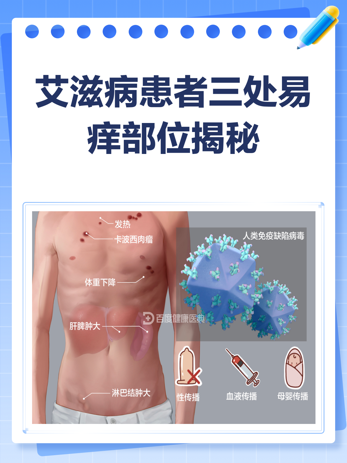 艾滋病一般哪三处会痒？快来了解一下
