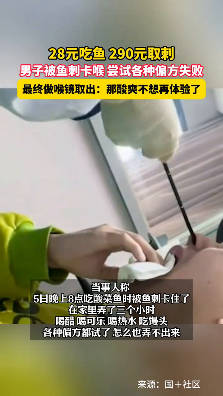 8元吃鱼290元取刺,男子被鱼刺卡喉最终做喉镜取出