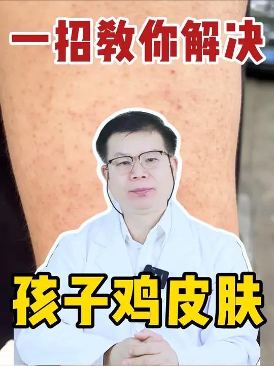 孩子胳膊腿上疙疙瘩瘩的鸡皮肤，医生教你解决！鸡皮肤皮肤#毛周角化