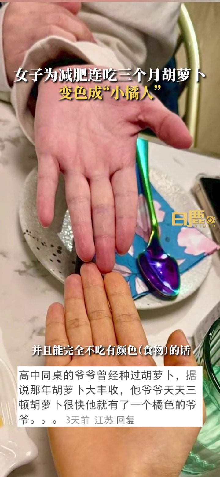 女子为减肥连吃3月胡萝卜变小橘人