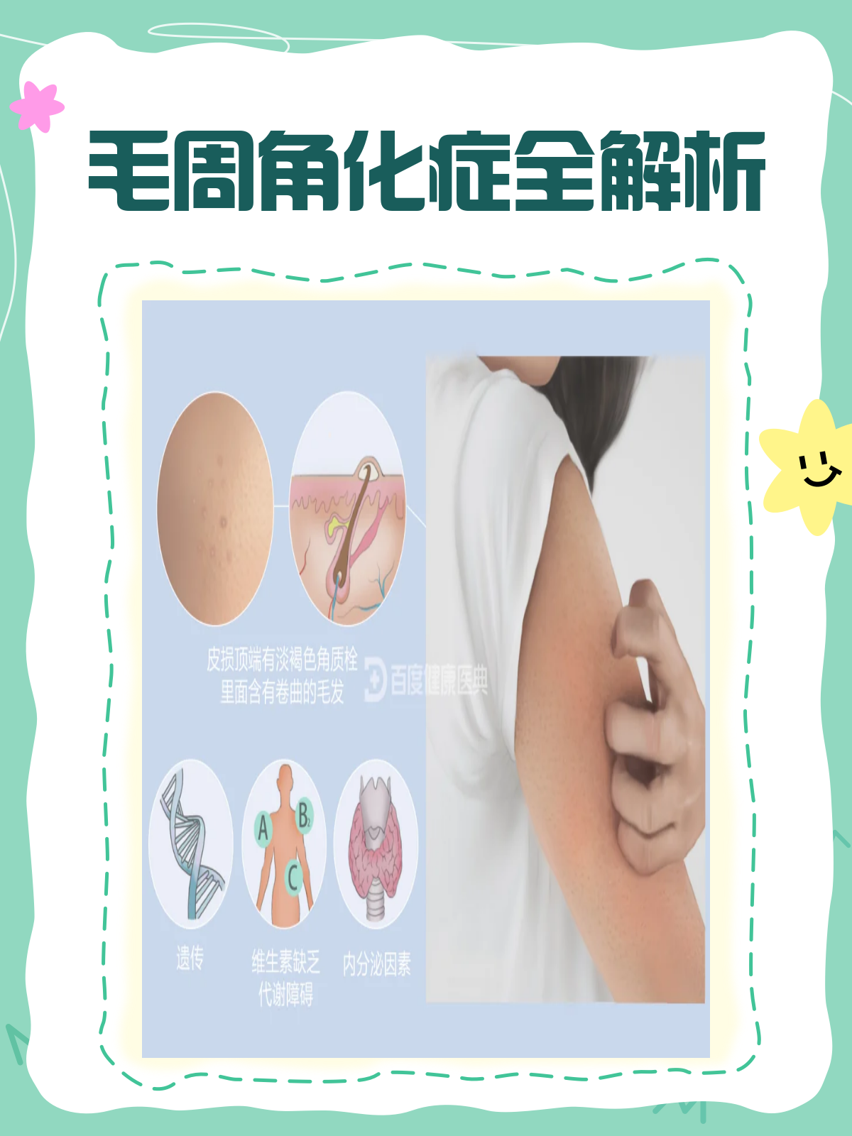 毛周角化症，你的“鸡皮肤”有救了！