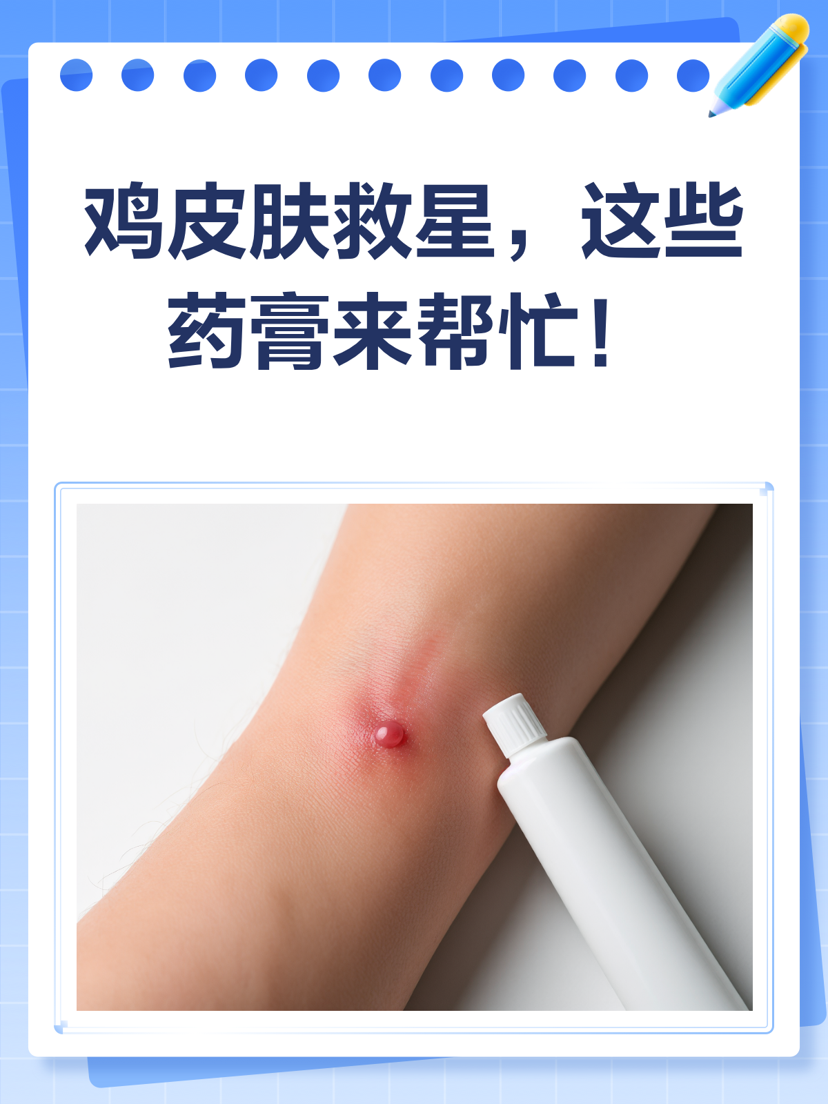 鸡皮肤烦恼?这些药膏来帮忙!