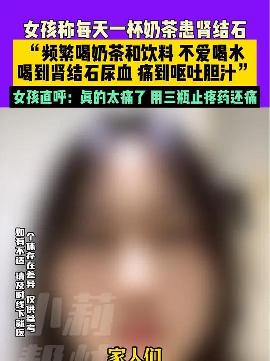 9月20日,上海,女孩称每天一杯奶茶患 肾结石,“频繁喝 奶茶 和 饮料,不爱喝水,喝到肾