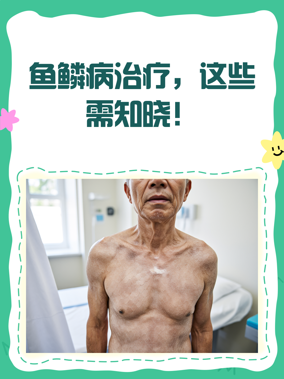 鱼鳞病治疗，别再迷信特效药了！