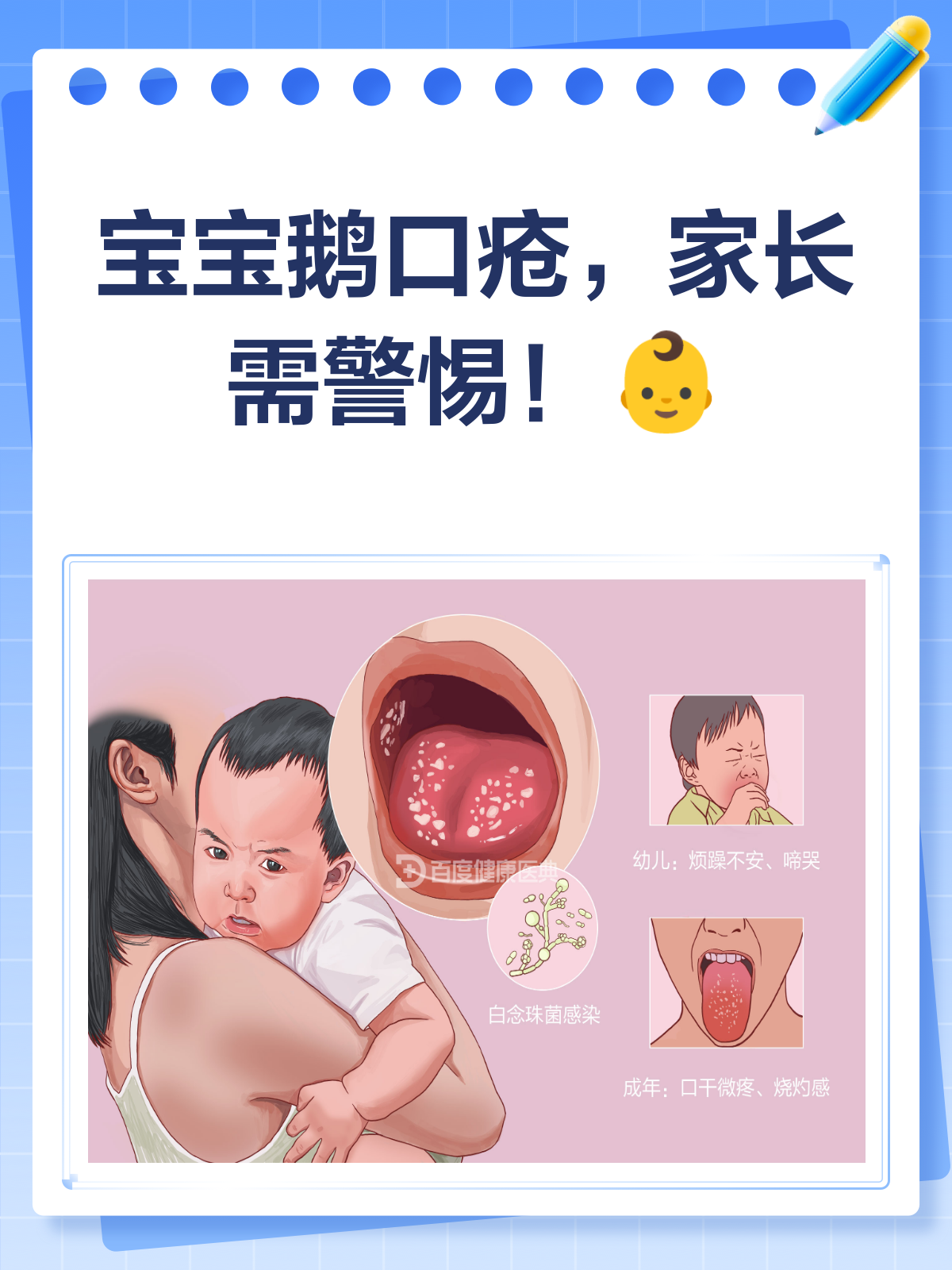 宝宝得了鹅口疮怎么办?别急,看这里!
