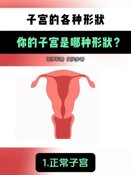 子宫各种形状 你的子宫是哪些形状?